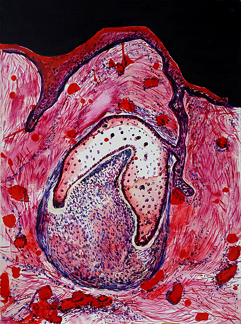 Infantka hematology, 2010