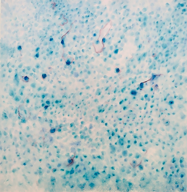 Treponema pallidum, 2024